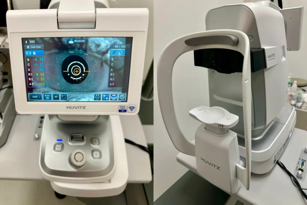 autokeratorefraktometrija podgorica crna gora oftalmoloski centar dr raonic oftalmolog oftalmohirurg autokeratorefractometry Montenegro Ophthalmology center ophthalmologist ophthalmic surgeon