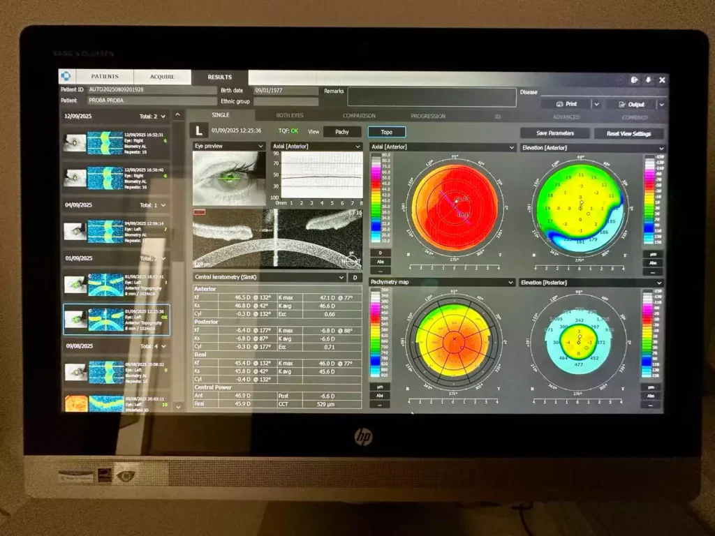 oct topografija podgorica crna gora oftalmoloski centar dr raonic oftalmolog oftalmohirurg OCT topography Montenegro Ophthalmology center ophthalmologist ophthalmic surgeon
