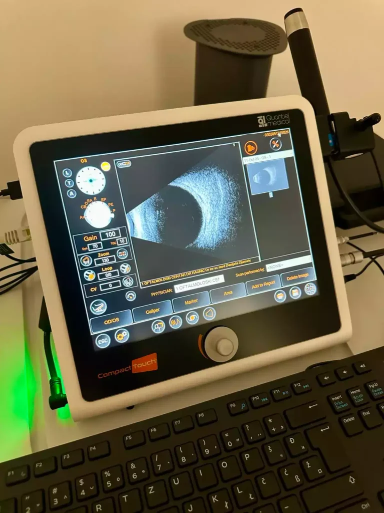 ultrazvucna dijagnostika podgorica crna gora oftalmolog oftalmohirurg oftalmoloski centar dr raonic ultrasound diagnostics Montenegro ophthalmologist ophthalmic surgeon Ophthalmology center