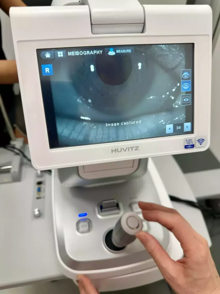 meibomografija oftalmoloski centar dr raonic podgorica crna gora meibography Ophthalmology center Montenegro